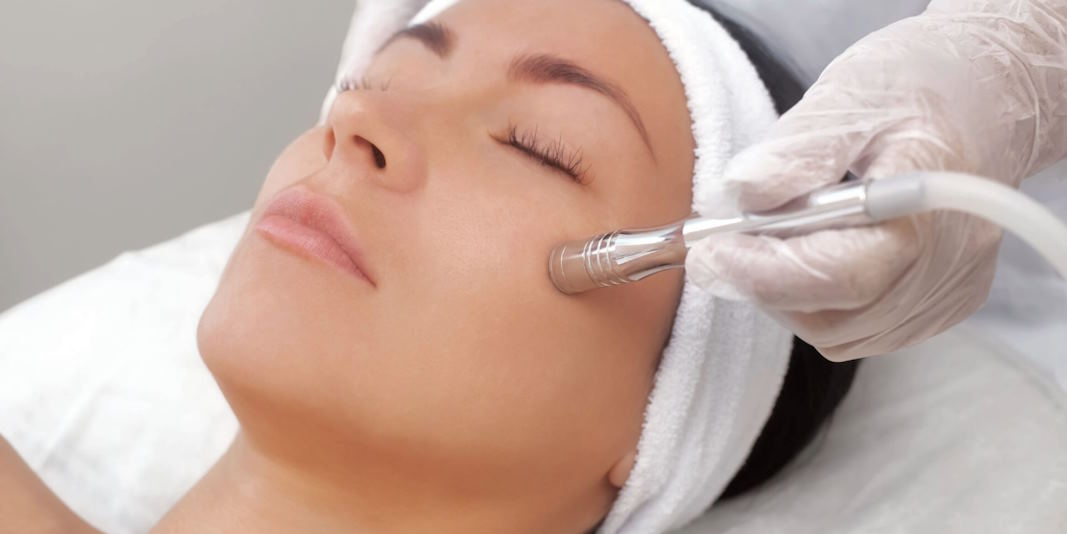 microdermabrasion sessions